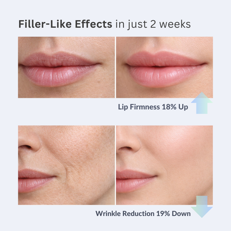 The Volufiline Infused Korean Collagen Serum