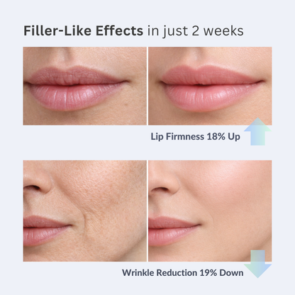 The Volufiline Infused Korean Collagen Serum