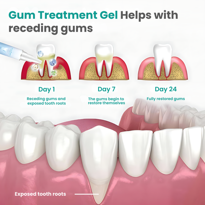 Opaline GumRepair System (VALUE)
