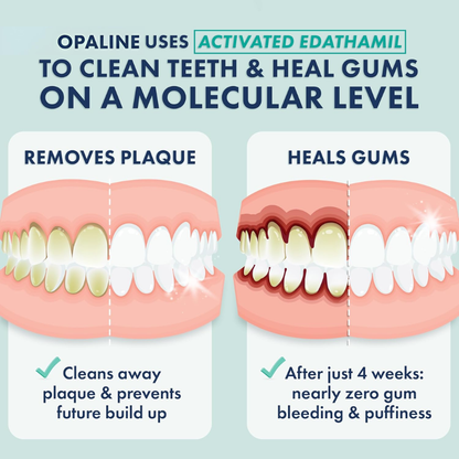 Opaline's Toothpaste Gel