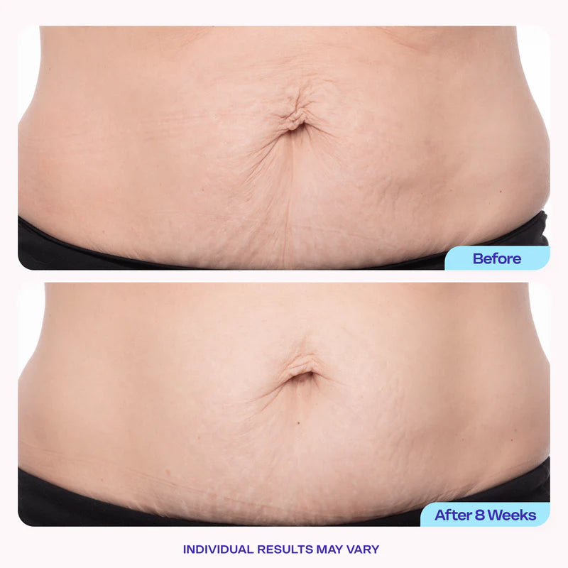 Postpartum Firming Cream