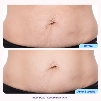 Postpartum Firming Cream