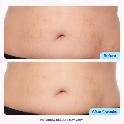 Postpartum Firming Cream