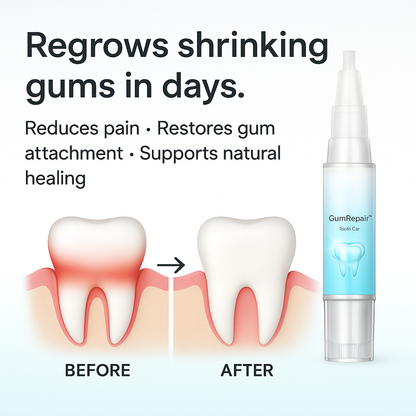 Opaline GumRepair System (VALUE)