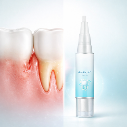 Opaline GumRepair System (VALUE)