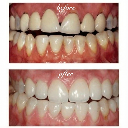Opaline GumRepair System (VALUE)