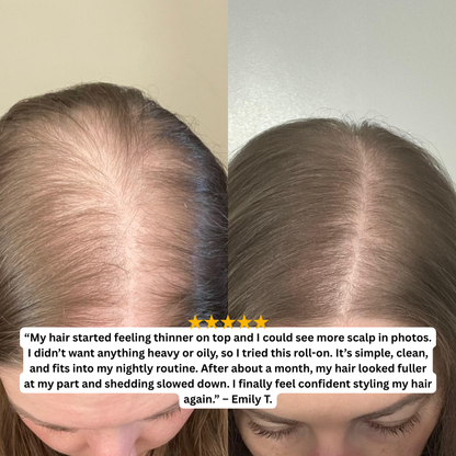Hair Growth Roller