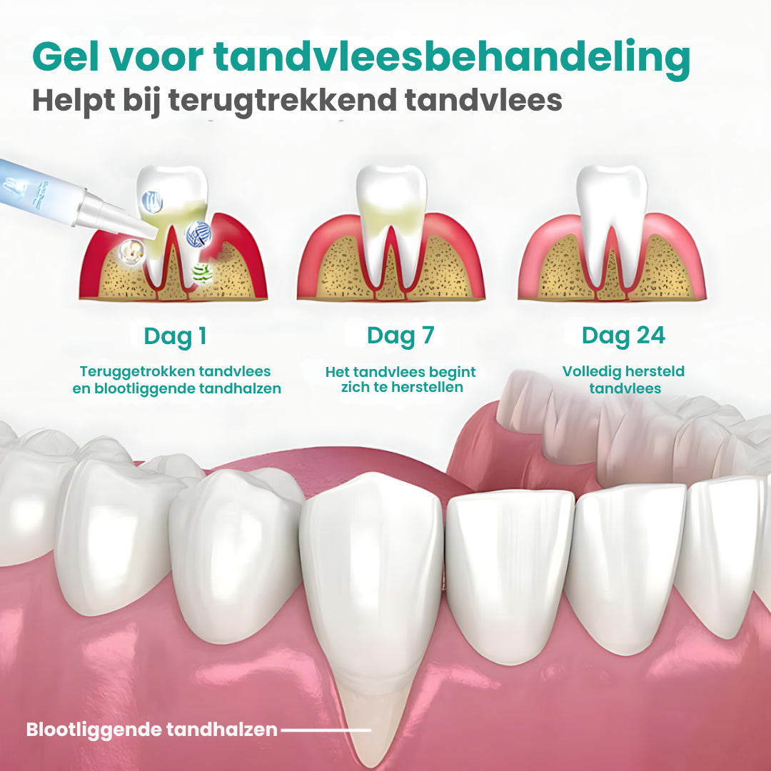 GumRepair™ | Herstel terugtrekkend tandvlees en bescherm je glimlach – helemaal natuurlijk
